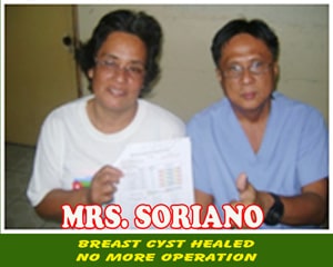 Mrs. Soriano (Breast Cyst Healed) Mrs. Soriano (Breast Cyst Healed)