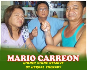 Mario Carreon (Kidney Stone Removed by Herbal Therapy) Mario Carreon (Kidney Stone Removed by Herbal Therapy)