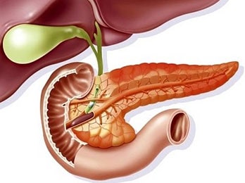 Acute Pancreatitis