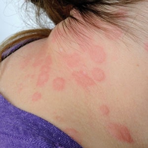 Bio washing discount powder rash