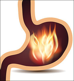 Agni in Ayurveda agni in ayurveda
