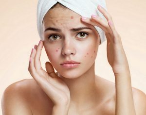 Get Rid of the Marks and Scars with Aloe Vera ?
