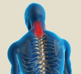 Cervical spondylitis