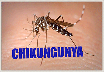 Chikungunya Chikungunya