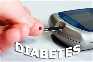 Diabetes Mellitus Diabetes Mellitus