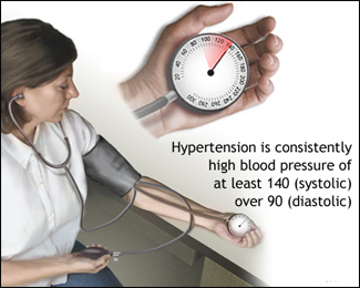 Hypertension (High Blood Pressure)