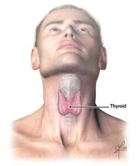 Hyperthyroidism
