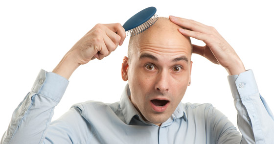 Baldness Baldness