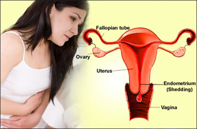 Excessive Menstrual Bleeding