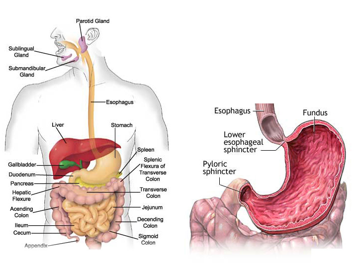 ulcerative colitis