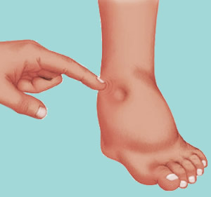 Water Retention