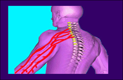 En trofast bekymre Bedstefar How to Treat Pinched Nerve Naturally?