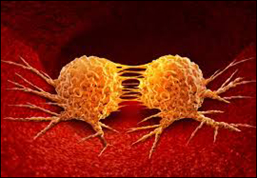 Metastasis Metastasis