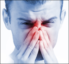Allergy Allergy