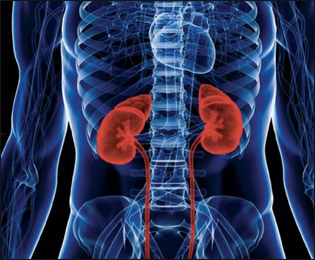Kidney Failure Kidney Failure