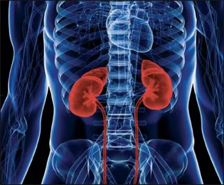Kidney Failure