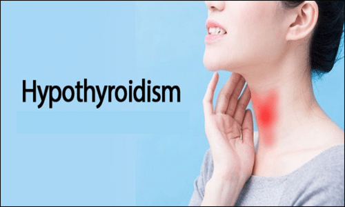 Hypothyroidism Hypothyroidism