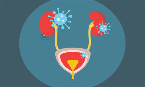 Urinary Tract Infection Urinary Tract Infection