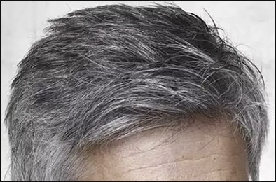 Premature Graying Or White Hair In Kids Causes  Prevention