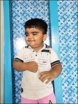 Case Study No: 153 | Nephrotic Syndrome – Shaurya