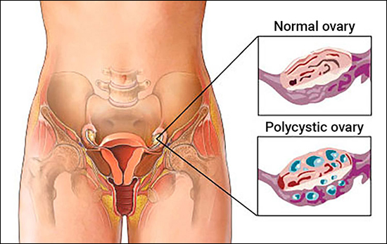 Pelvic Floor Problems in the Adult Athlete: Help for Muscle-Related Pain -  YogaUOnline