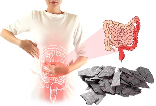 Parpati Kalpana, Ulcerative Colitis