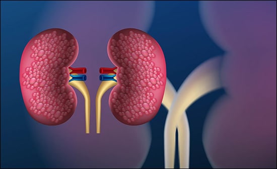 Kidney Disease