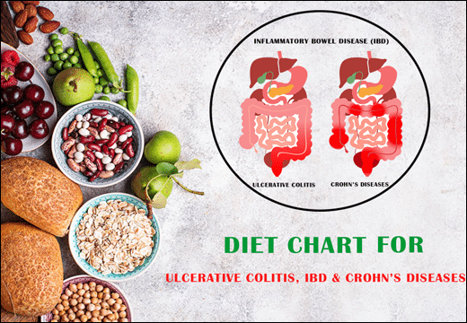 Diet Chart For Ulcerative Colitis IBD Crohn s Diseases diet-chart-for-ulcerative-colitis-ibd-crohn-s-diseases