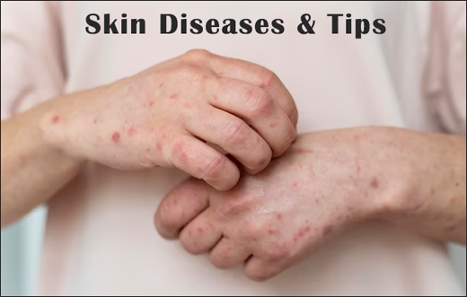 Skin Diseases And Tips Skin diseases, Tips, Principles Of Treatment Of Skin Diseases And Tips, Facts about skin, Common skin problems, Functions of skin, Ayurvedic aspect on skin disease, Prevalence of skin disease, Diet and lifestyle