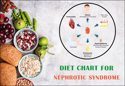 Diet Chart For Nephrotic Syndrome Food To Take Food To Avoid