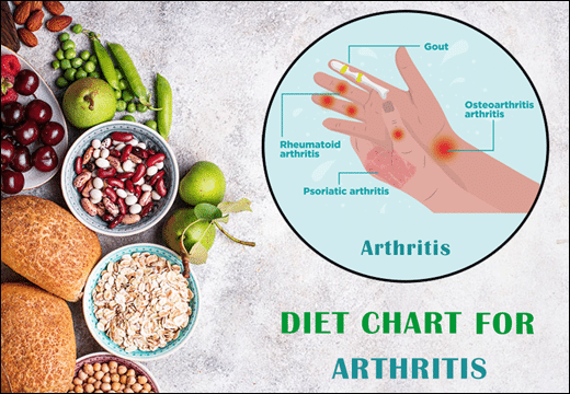 Diet Chart For Arthritis Arthritis, Diet Chart for Arthritis, Diet Plan for Arthritis, Joints Pain, Arthritis Diseases, Arthritis Diet Chart, Arthritis Diet Plan, Planet Ayurveda Diet Chart, Planet Ayurveda Diet Chart For Arthritis