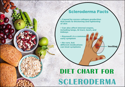 Diet Chart For Scleroderma Scleroderma, Diet Chart for Scleroderma, Diet Plan for Scleroderma, Scleroderma Diet Chart, Scleroderma Diet Plan, Planet Ayurveda Diet Chart, Planet Ayurveda Diet Chart For Scleroderma, Diet Chart For Scleroderma Patient
