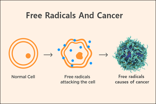 Free Radicals And Cancer Free Radicals, Cancer, Cancer Cells Free Radicals, Role Of Free Radicals, Cause Of Free Radicals Formation, How Cancer Is Caused, DNA Repair Mechanism, How Ayurveda Is Helpful, The Rescuer Diet, Green Juice, Red Juice, Ayurvedic Herbs, Karka Roga In Ayurveda