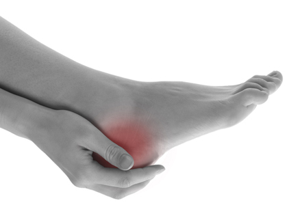 Home Remedies for Heel Spur