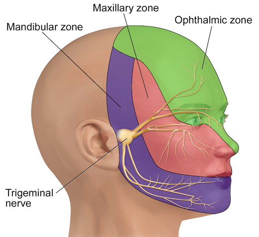 Trigeminal Neuralgia Trigeminal Neuralgia