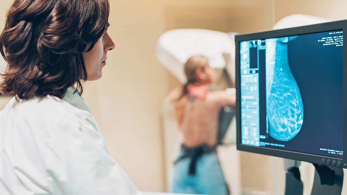 Mammography