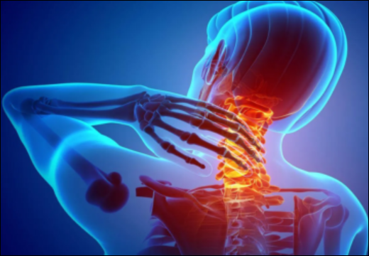 Polymyalgia Rheumatica (PMR)