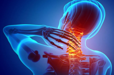 Polymyalgia rheumatica (PMR)