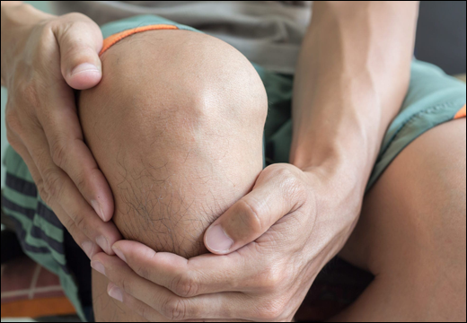 Pigmented Villonodular Synovitis