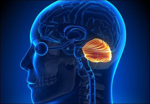 Spinocerebellar Ataxia Type 12 (SCA12)