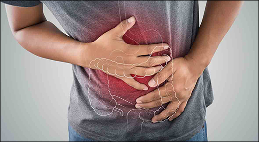 Ulcerative Colitis, IBS, Crohn's Disease Ulcerative Colitis, IBS, Crohn's Disease