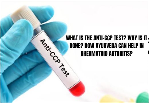 Anti-CCP Test Anti-CCP Test