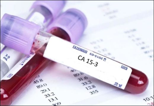 CA 15.3 Test CA 15.3 Test