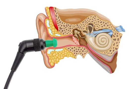 Otoacoustic Emissions (OAE) Otoacoustic Emissions (OAE)