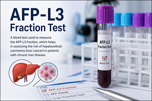 AFP-L3 Fraction
