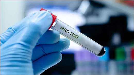Measurable Residual Disease (MRD) Testing