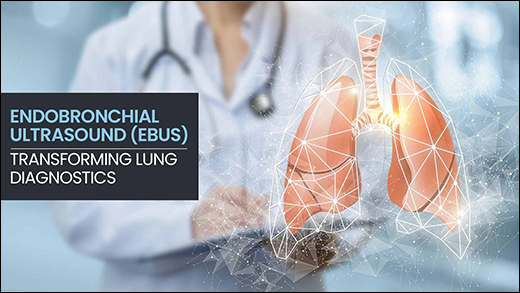 Endobronchial Ultrasound (EBUS)