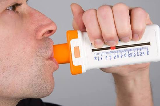 Fractional Exhaled Nitric Oxide (FeNO)