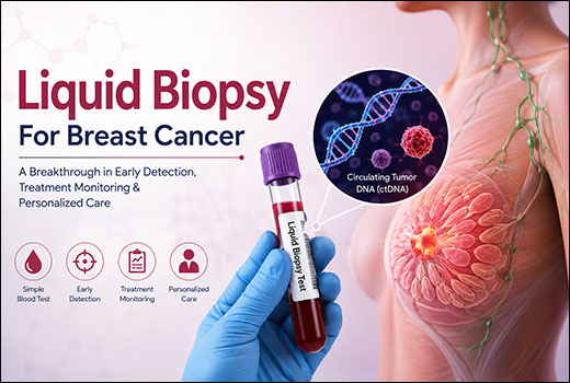 Liquid Biopsy For Breast Cancer