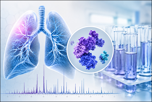Proteomic Lung Biomarker Panels